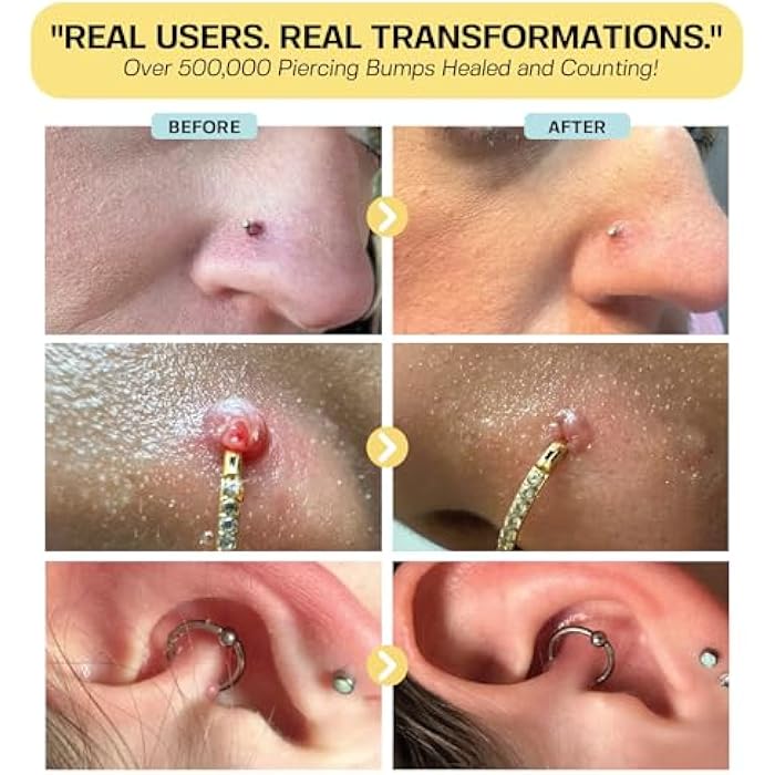 BASE LABORATORIES Piercing Bump Solution & Keloid Bump Removal | Soothing Piercing Aftercare for Piercing Bumps & Keloid Scar Removal | Ear & Nose Keloid Bumps Piercing Aftercare Solution Oil | 0.5 oz - Image 4